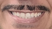 BigoDiN