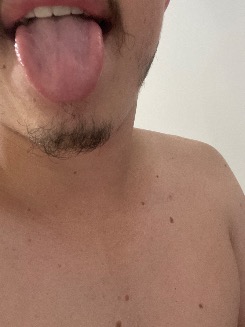 Garoto22a