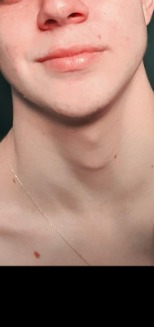 Vh